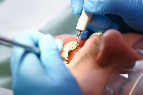 Emergency Gum Pain Relief in LA