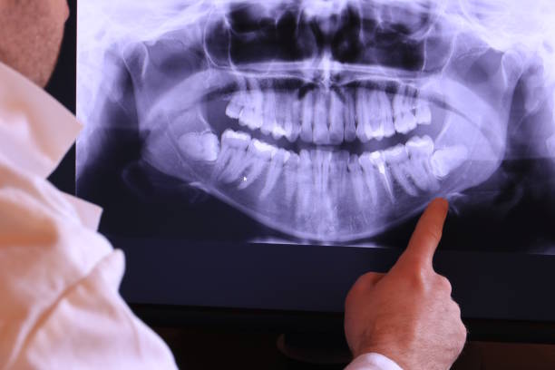 Best Walk-In Dentist Near Me  in Bawcomville, LA